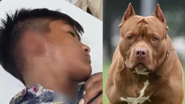 Pitbull ने फिर किया बच्चे पर अटैक, नोच डाला कान