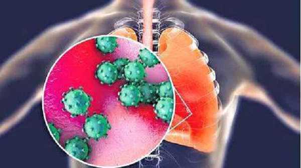झारखंड में एडिनो वायरस (H3N2)से लोग पड़ रहे बीमार, डाक्टरों ने जताई चिंता, गाइडलाइन जारी